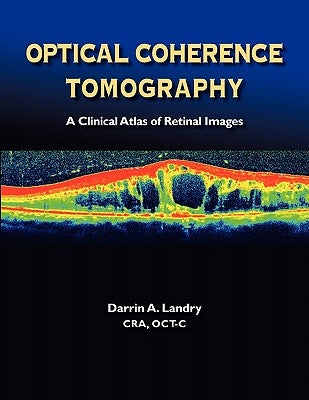 Optical Coherence Tomography a Clinical Atlas of Retinal Images by Landry, Darrin A.