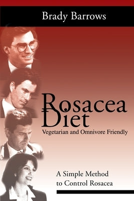 Rosacea Diet: A Simple Method to Control Rosacea by Barrows, Brady