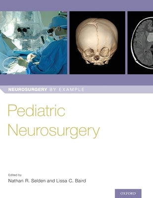 Pediatric Neurosurgery by Selden, Nathan