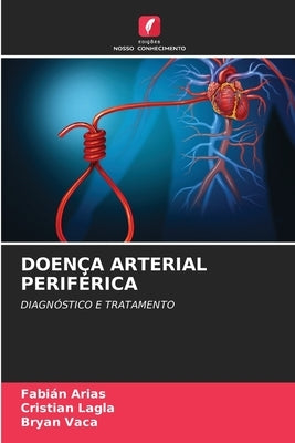 Doença Arterial Periférica by Arias, Fabián