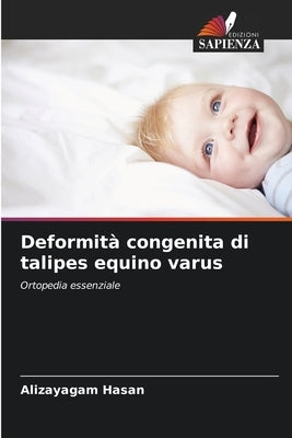 Deformità congenita di talipes equino varus by Hasan, Alizayagam