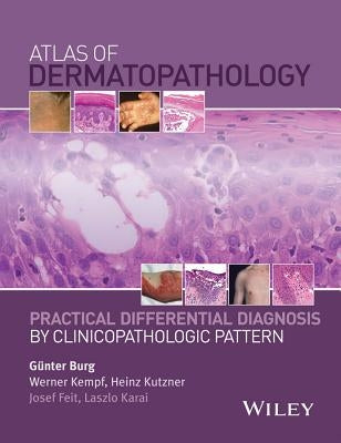 Atlas of Dermatopathology: Practical Differential Diagnosis by Clinicopathologic Pattern by Burg