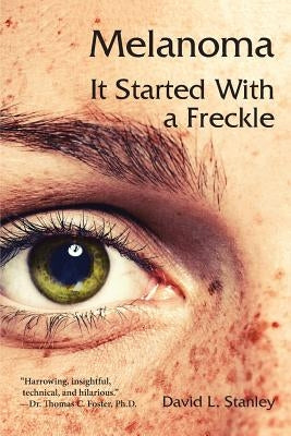 Melanoma: It Started With a Freckle by Stanley, David L.