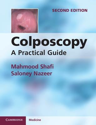 Colposcopy by Shafi, Mahmood