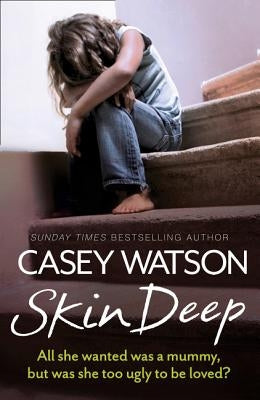 Skin Deep: All She Wanted Was a Mummy, But Was She Too Ugly to Be Loved? by Watson, Casey
