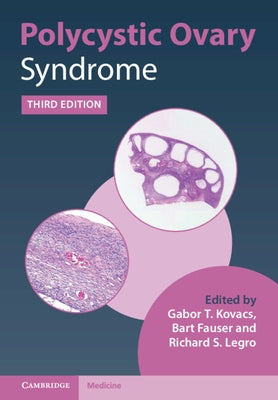 Polycystic Ovary Syndrome by Kovacs, Gabor T.