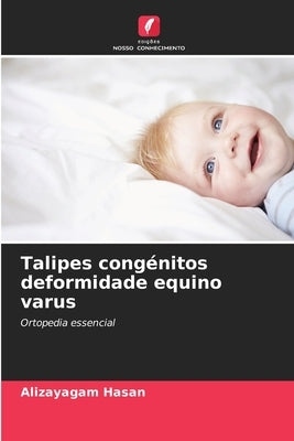 Talipes congénitos deformidade equino varus by Hasan, Alizayagam