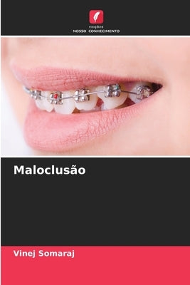 Maloclusão by Somaraj, Vinej