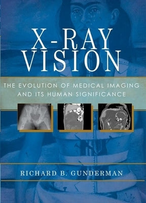 X-Ray Vision: The Evolution of Medical Imaging and Its Human Significance by Gunderman, Richard B.