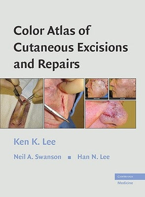 Color Atlas of Cutaneous Excisions and Repairs by Lee, Ken K.