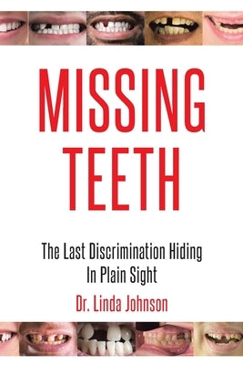Missing Teeth: The Last Discrimination Hiding in Plain Sight by Johnson, Linda