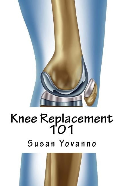 Knee Replacement 101: A User's Guide to Preparation for and Recovery After Knee Arthroplasty by Yovanno, Susie