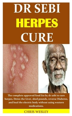 Dr Sebi Herpes Cure: The complete approved food list by dr sebi to cure herpes, Detox the Liver, shed pounds, reverse Diabetes, and heal th by Wesley, Chris