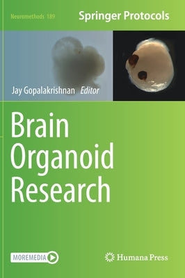 Brain Organoid Research by Gopalakrishnan, Jay