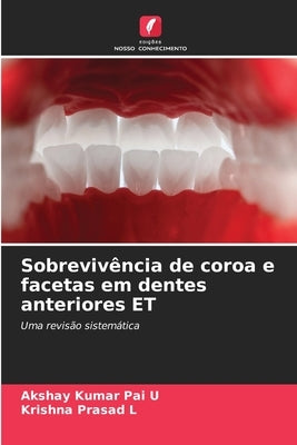 Sobrevivência de coroa e facetas em dentes anteriores ET by Pai U., Akshay Kumar