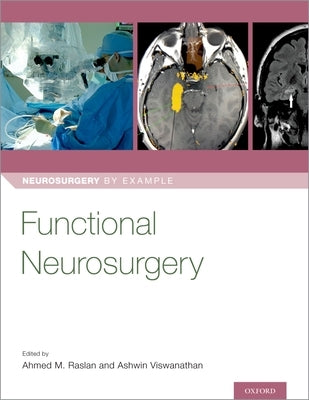 Functional Neurosurgery by Raslan, Ahmed